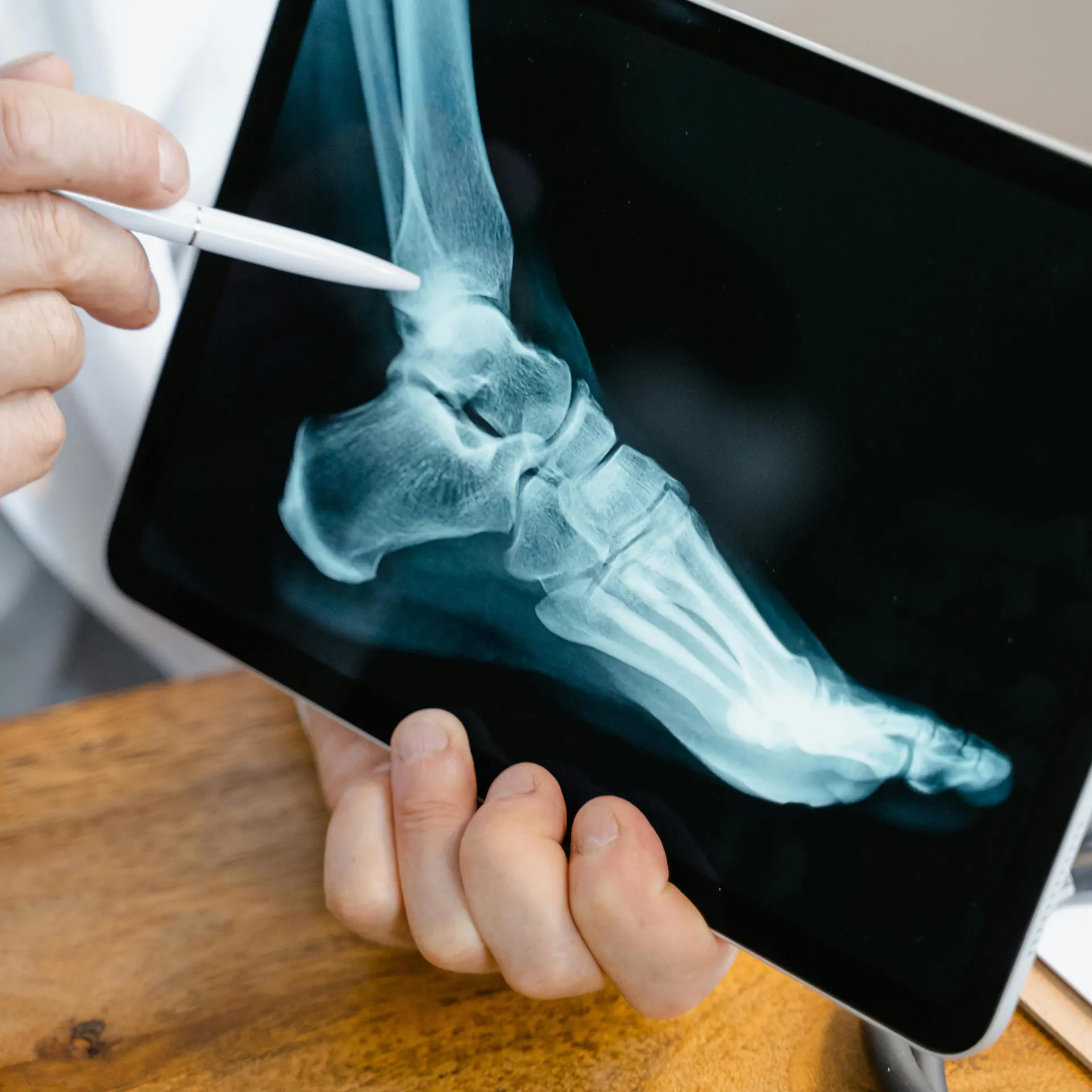 Bone Health Infusions for Osteoporosis